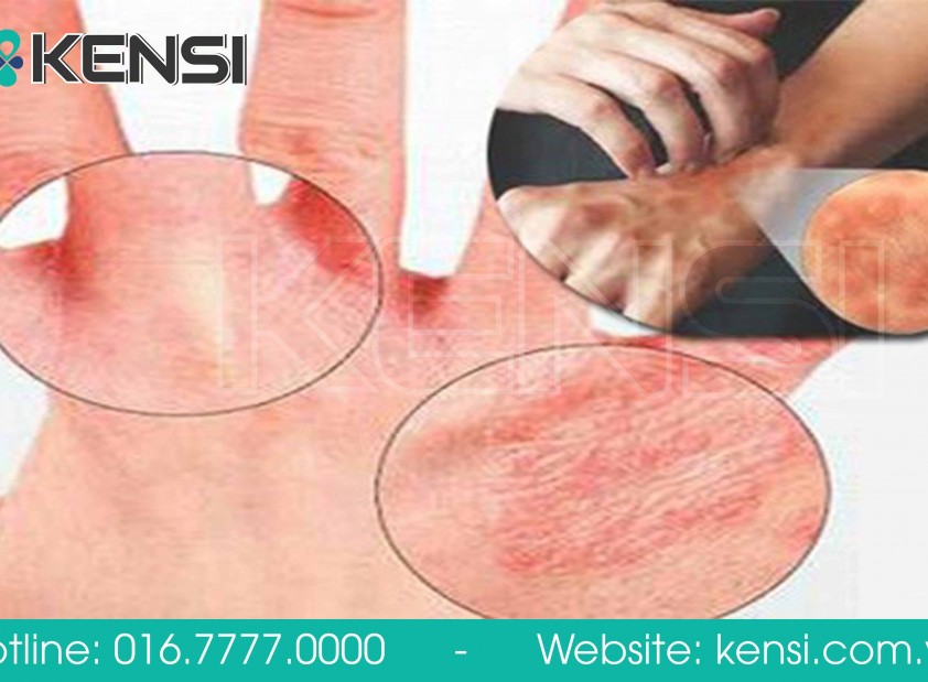 Tác hại từ việc sử dụng máy lọc nước RO kém chất lượng